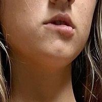 emmaontop Nøgen