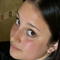 keshaortegafree Nøgen